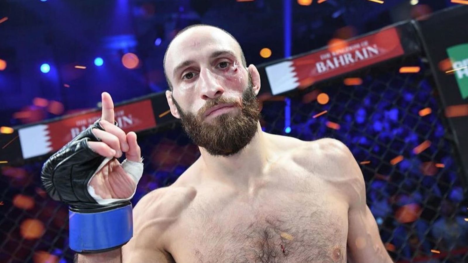 Fighter with vitiligo signs a contract with UFC and will replace Kutateladze in a fight with Moises