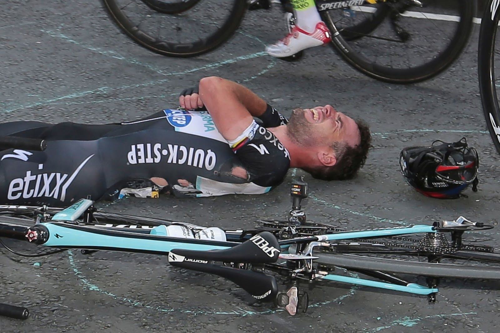 Cycling: Mark Cavendish suffers gruesome injury