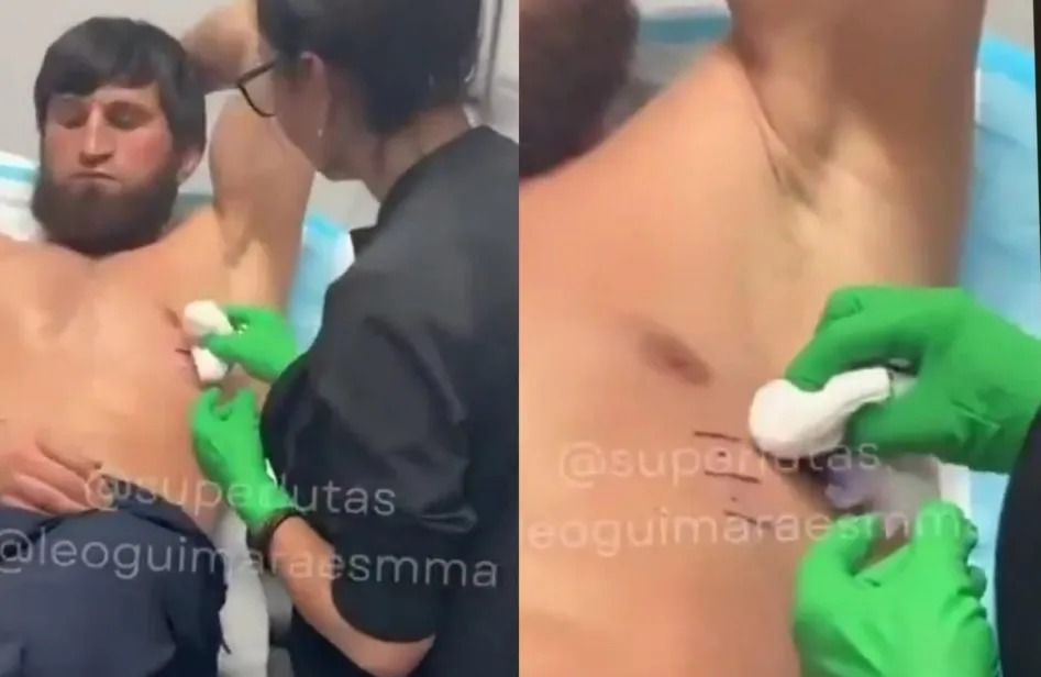 Ankalaev Broke a Rib Before Rematch With Pereira