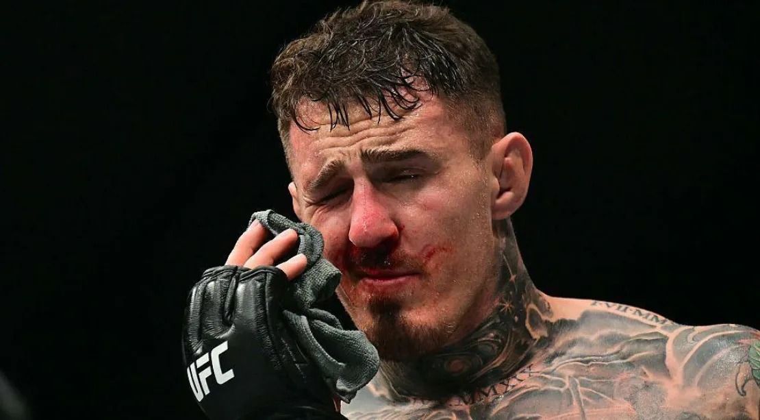 UFC Champion Aspinall Unable to Name Return Date