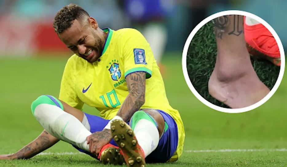 Neymar injures his ankle in Brazil's opening match at 2022 World Cup