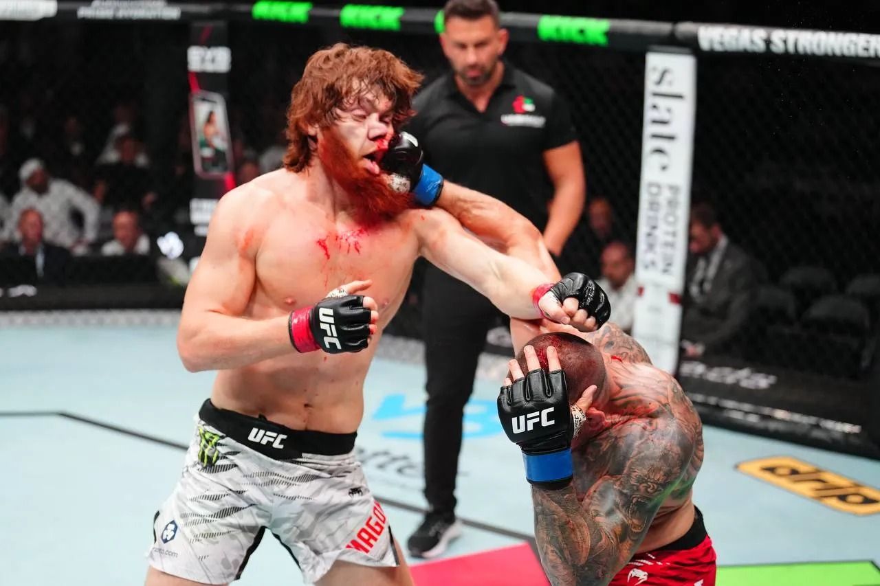 Coach Reveals Shara Bullet’s Recovery Timeline After Broken Nose