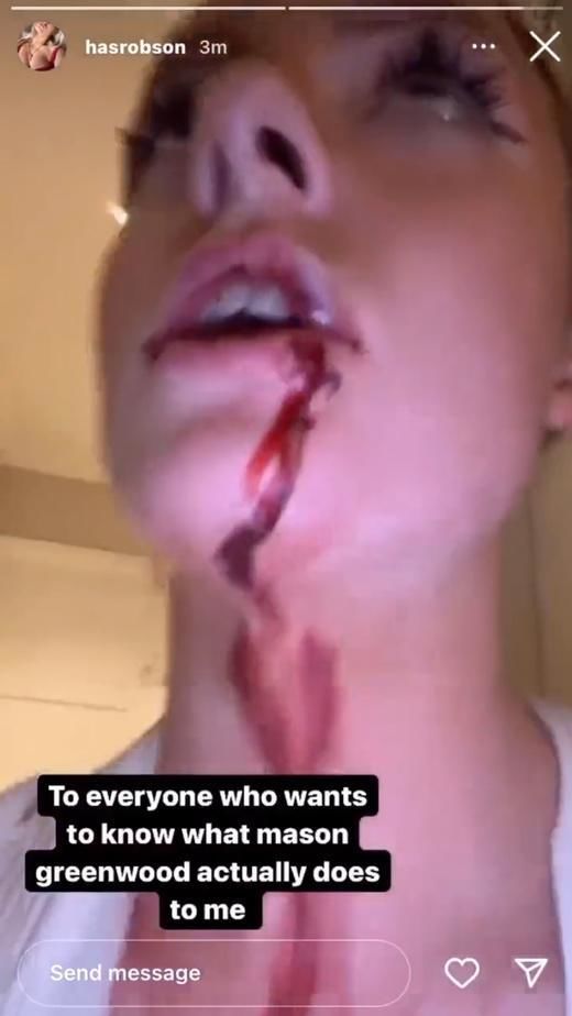 Screenshot from Harriet Robeson's Instagram story Screenshot from Harriet Robeson's Instagram story