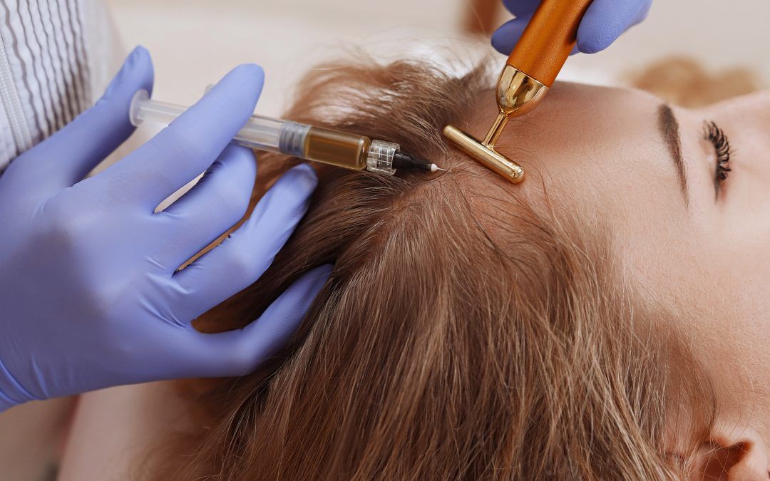 La mesoterapia es una técnica para promover el crecimiento del cabello